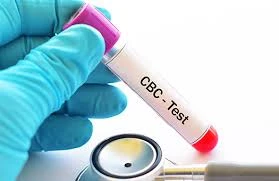 CBC (Complete Blood Count) Test